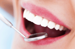 Oral Health Checkup by Dentist Pennant
