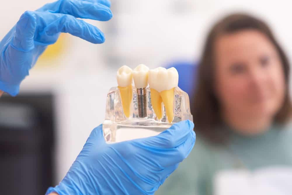 Close-up of dental model with implant. patient of dental clinic on blurred background. dentistry